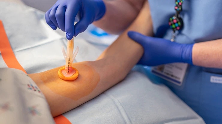 <h3>PREPARE la piel</h3>
<p>Con el fin de facilitar el mantenimiento de un entorno estéril, lleve a cabo la antisepsia de la piel mediante el procedimiento correcto. Utilice el aplicador estéril de un solo uso que contiene una solución de clorhexidina alcohólica como agente antiséptico.<sup>2*</sup></p>
<p><sup>2*. Infusion Nurses Society. Infusion Therapy Standards of Practice. J Infus Nurs. 2021; 44(1S): S96.</sup></p>
<p><a href="#contactus" title="Enlace al formulario de la página Contar con BD como aliado" target="_blank" rel="noopener noreferrer">Ayúdenos a identificar posibles áreas de mejora para mejorar la práctica clínica en el centro &gt;&gt;</a></p>
