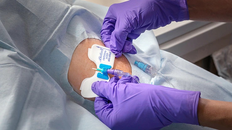 <h3>PROTEJA el catéter</h3>
<p>Estabilice y fije el catéter en el punto de inserción. El uso de dispositivos de fijación diseñados con sistemas adhesivos (ESD) puede reducir el riesgo de complicaciones, como infecciones y desplazamiento del catéter.<sup>2*</sup></p>
<ul>
<li>Dispositivos de fijación de catéteres intravenosos</li>
</ul>
<p><sup>2*. Infusion Nurses Society. Infusion Therapy Standards of Practice. J Infus Nurs. 2021; 44(1S): S109.</sup></p>
<p><a href="#contactus" target="_blank" rel="noopener noreferrer">Ayúdenos a identificar posibles brechas para mejorar la práctica clínica en el centro &gt;&gt;</a></p>
<p>&nbsp;</p>
