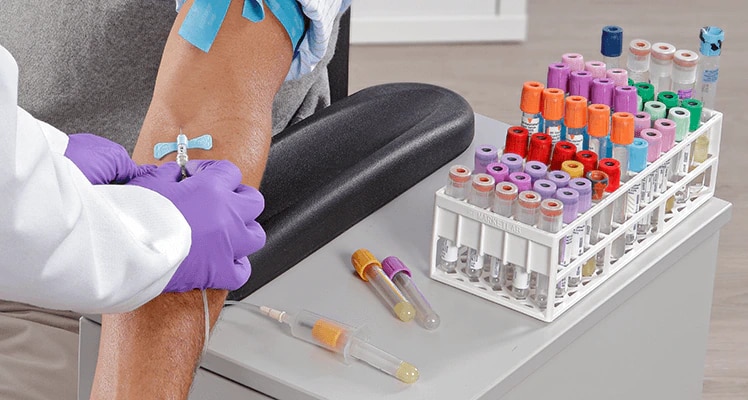 vacutainer-blood-tubes_C_PAS_BC_0616-0053.png