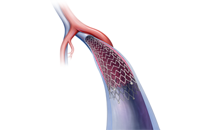 venovo-closeup.png